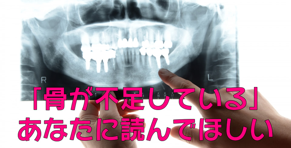 骨が不足していると言われたことのあるあなたに読んでほしい！